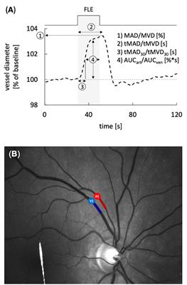 Non-invasive Assessment of Neurovascular Coupling After Aneurysmal Subarachnoid Hemorrhage: A Prospective Observational Trial Using Retinal Vessel Analysis